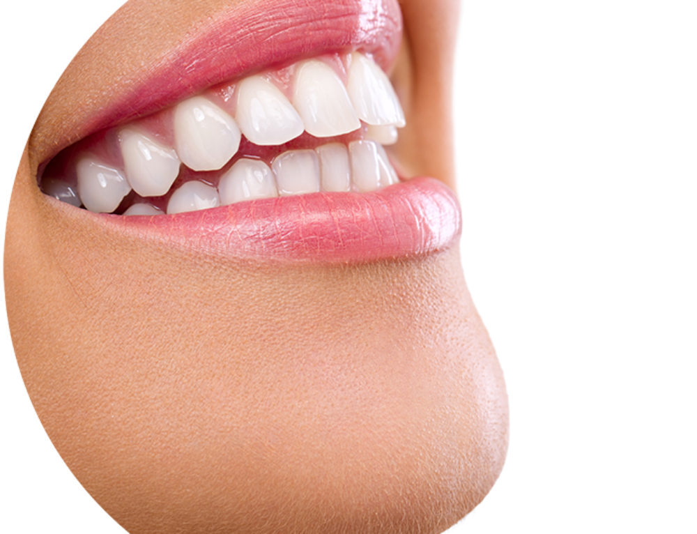 Bulk Bill Dentist in Logan Road Dental